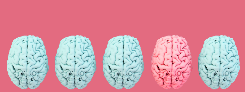 The new brain drain